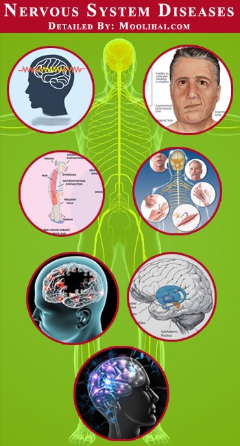nervous-system-diseases